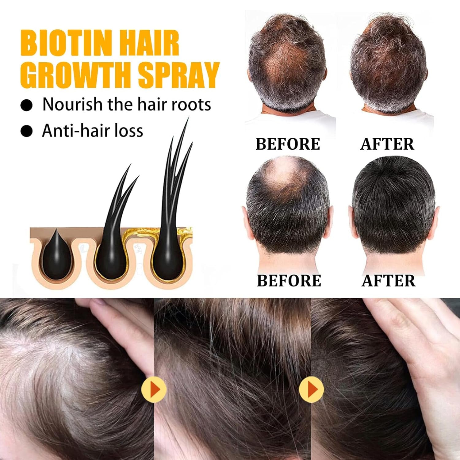 2 bucăți Biotin spray de creștere a părului, ser de creștere a părului, creșterea părului, spray de creștere a părului pentru femei și bărbați, anti-căderea părului, promovează părul mai gros, mai plin și cu creștere mai rapidă Ingrijirea parului Naty Shop