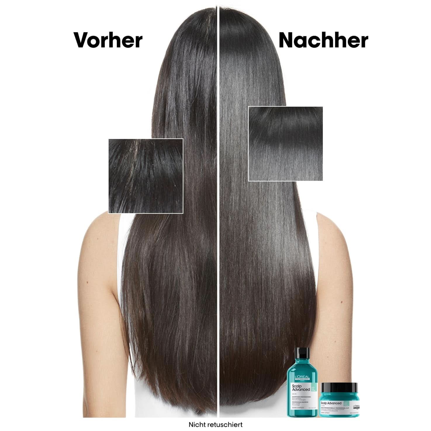 L'Oréal Professionnel Șampon de păr pentru curățarea scalpului gras, 300 ml Duș și baie Naty Shop