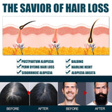 Miioto Hair Growth Serum, 180 ML Produs de creștere a părului pentru bărbați, ser de păr pentru creșterea părului, îngrijirea scalpului Promovează părul mai gros Hrănește scalpul și previne căderea părului Ingrijirea parului Naty Shop