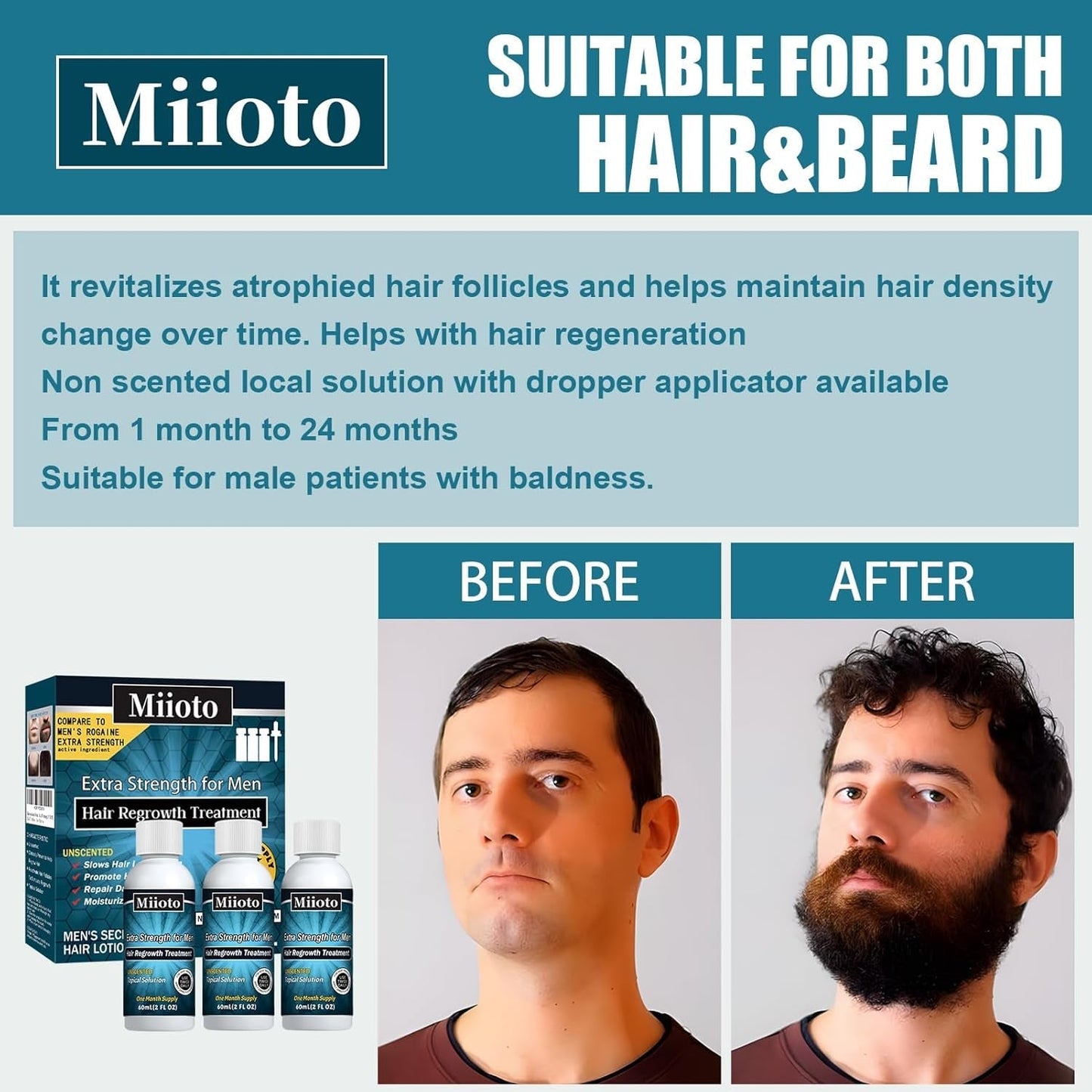 Miioto Hair Growth Serum, 180 ML Produs de creștere a părului pentru bărbați, ser de păr pentru creșterea părului, îngrijirea scalpului Promovează părul mai gros Hrănește scalpul și previne căderea părului Ingrijirea parului Naty Shop