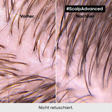 L'Oréal Professionnel Șampon de păr pentru curățarea scalpului gras, 300 ml Duș și baie Naty Shop