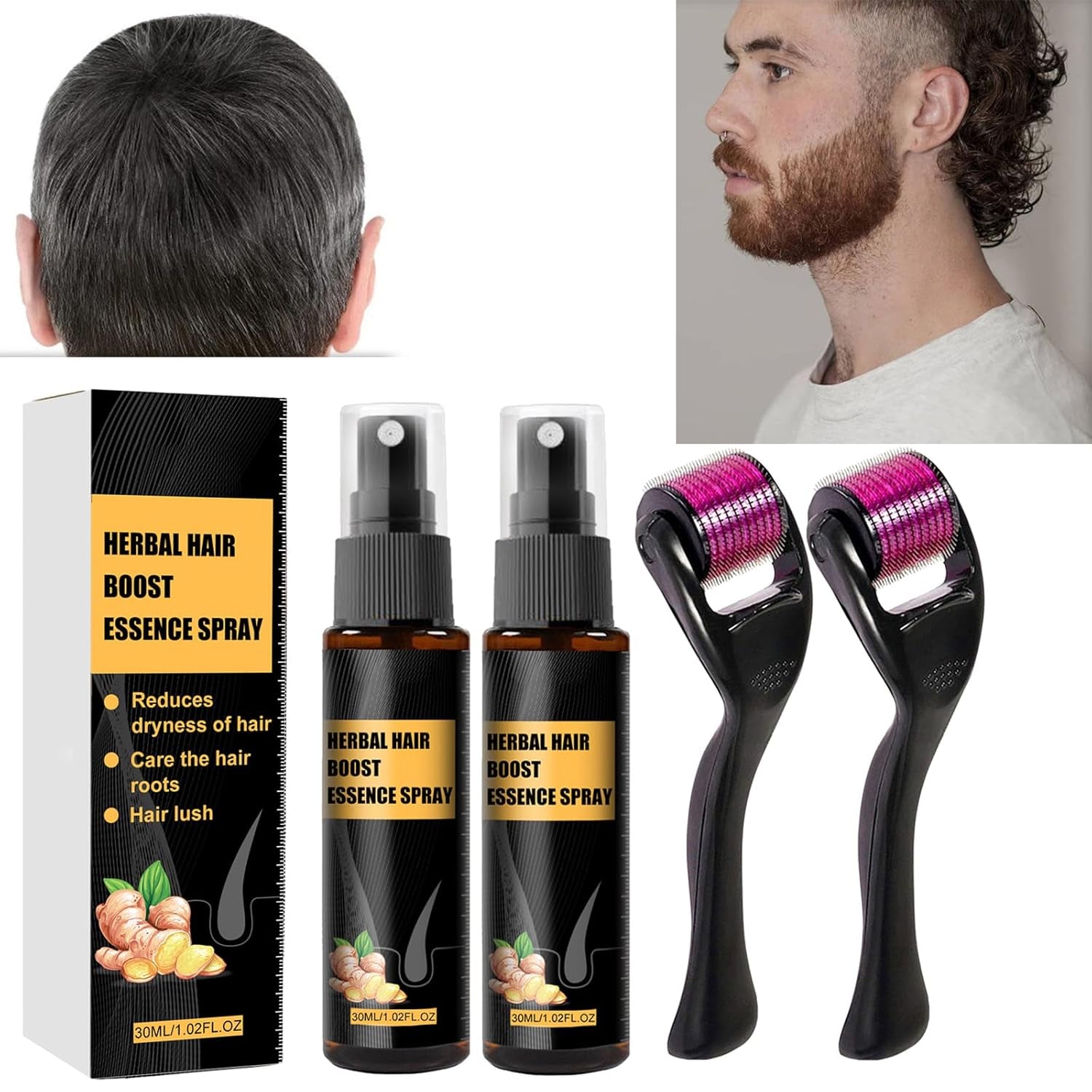 Kit de tratament avansat pentru creșterea părului 30ml 2PCS, spray pentru creșterea părului, set de role și esențe pentru creșterea părului, ser pentru creșterea părului, împotriva căderii părului, ser pentru creșterea avansată a părului Ingrijirea parului Naty Shop Titlu implicit