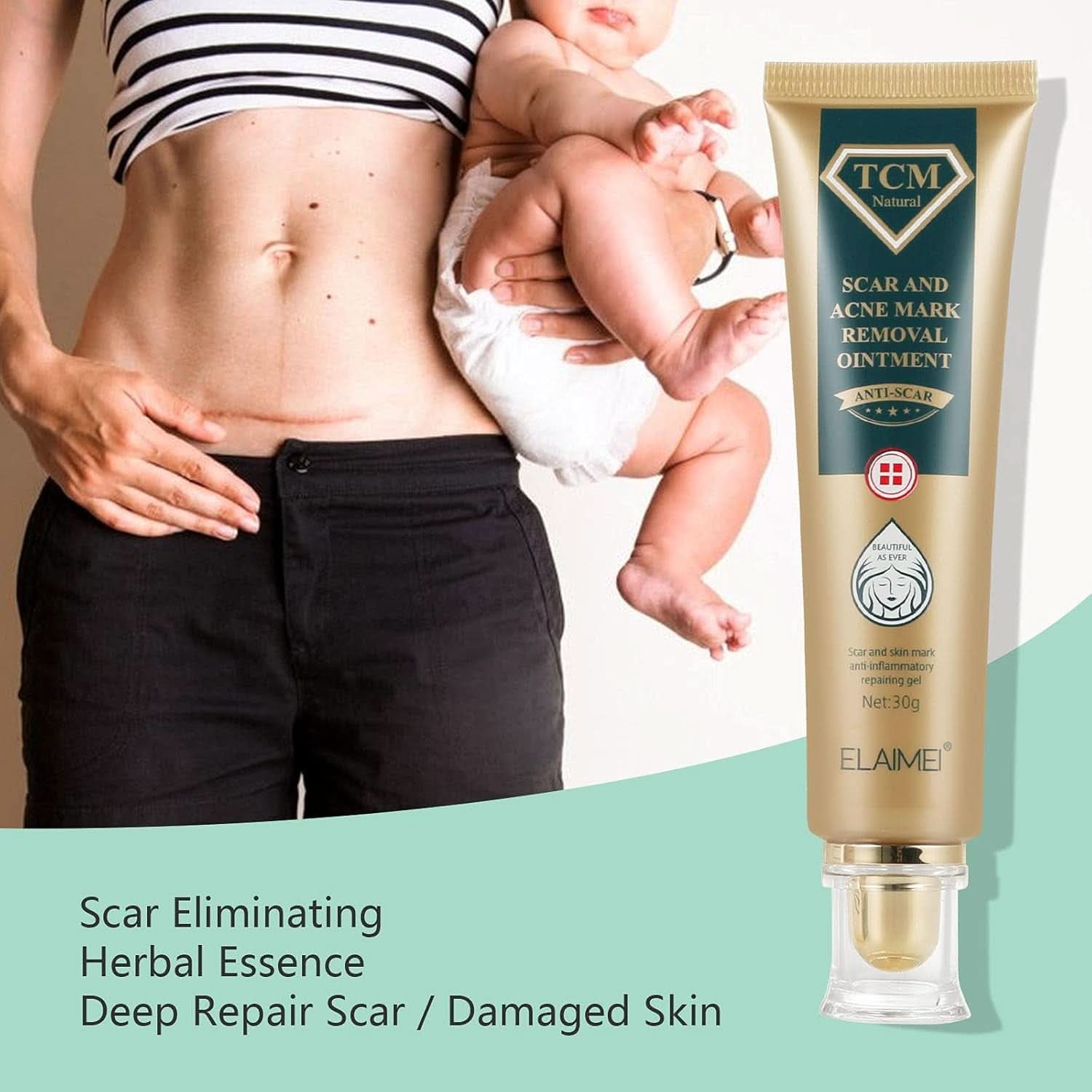 Gel pentru cicatrici, 30g Cosmetice si Infrumusetare Naty Shop