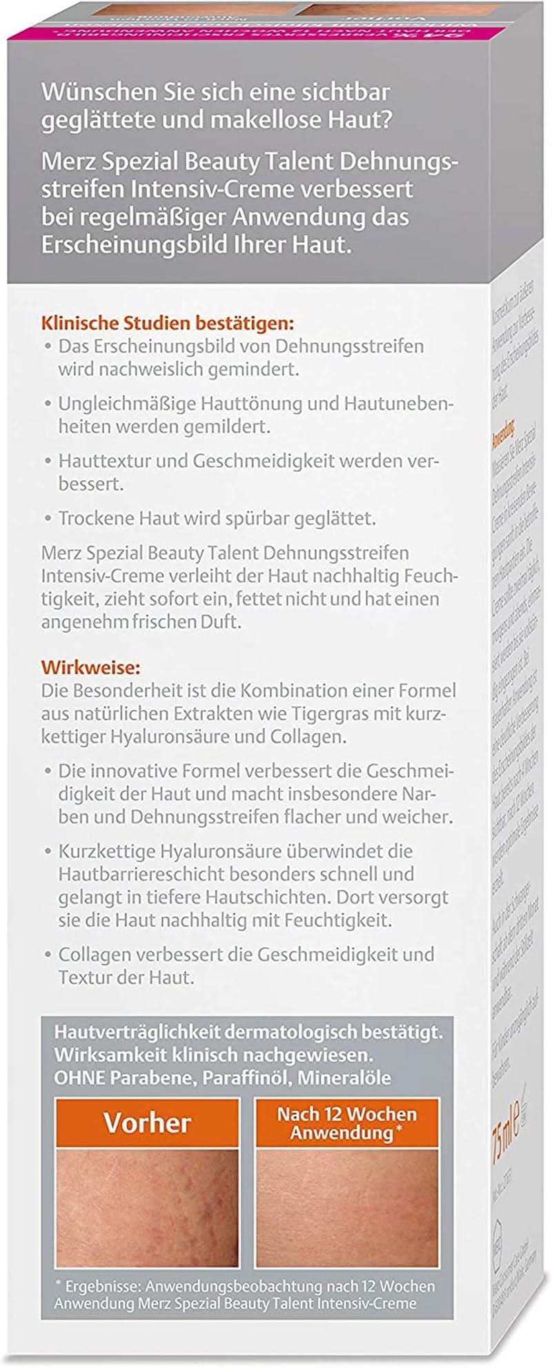 Merz Spezial, Crema intensiva pentru vergeturi, 75 ml Cosmetice si Infrumusetare Naty Shop